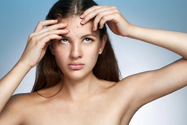 summer skin problems dry skin 600x400 summer skin problems dry skin 600x400